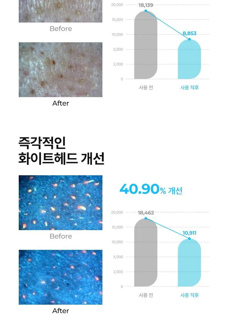 [말끔모공/촉촉보습]비알머드 딥 멜팅 머드 포어 클렌징오일 200ml 상세페이지 24